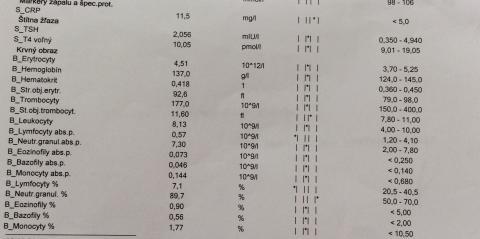 Poradna A Zkušenosti Lymfocytopenia? Nizka Hodnota Lymfocytov V Krvi ...